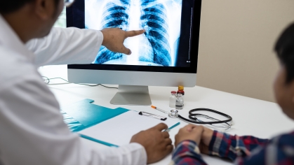doctor show TB x-ray